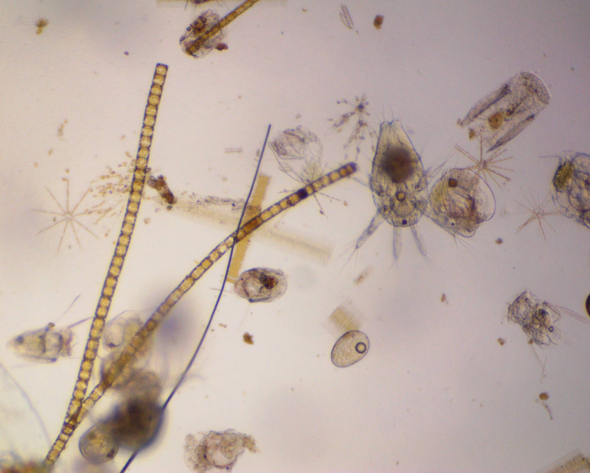 Plankton under microscope